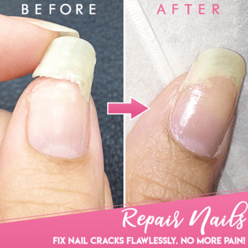 Gel reparador de unhas